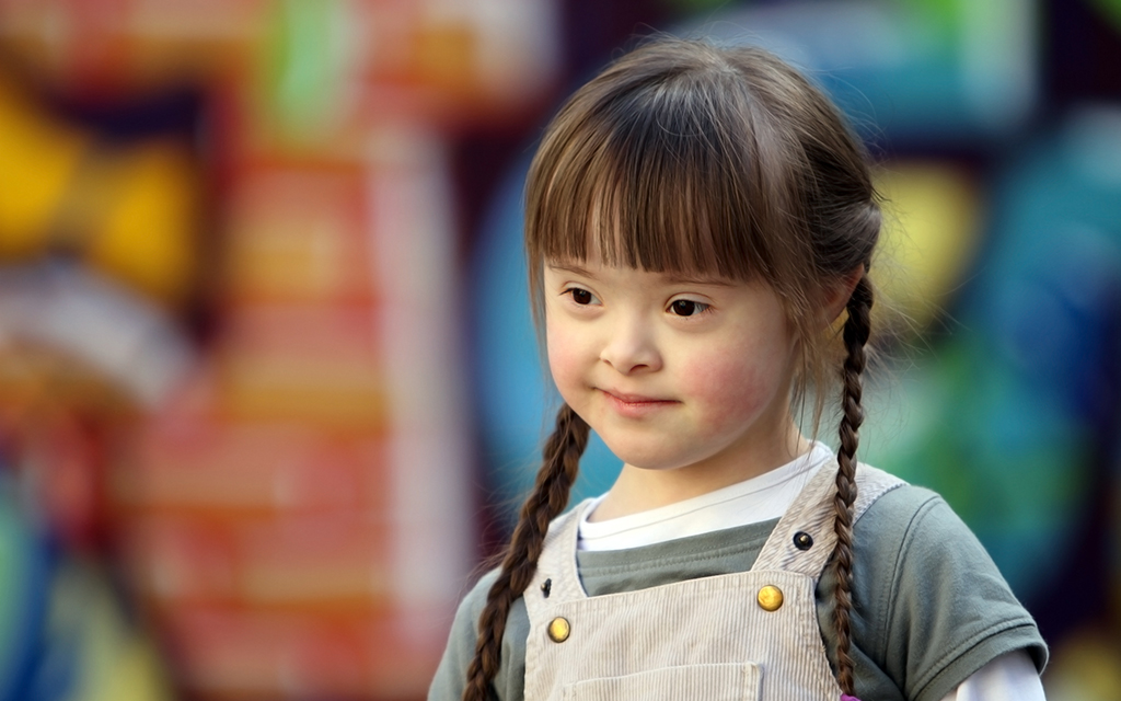 نحوه نگهداری و مراقبت از کودک سندروم داون مشاوره خانواده کانون